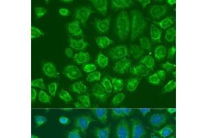 Immunofluorescence analysis of U2OS cells using MTDH Polyclonal Antibody at dilution of 1:100. (MTDH antibody)
