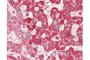Anti-RBM38 antibody IHC staining of human liver. (RBM38 antibody  (AA 41-90))