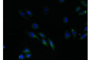Immunofluorescent analysis of HepG2 cells using ABIN7151168 at dilution of 1:100 and Alexa Fluor 488-congugated AffiniPure Goat Anti-Rabbit IgG(H+L) (RNF183 antibody  (AA 1-161))