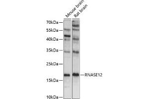 Western blot analysis of extracts of various cell lines, using RN antibody (ABIN7269985) at 1:1000 dilution. (RNASE12 antibody  (AA 1-100))