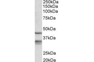 Western Blotting (WB) image for anti-Hydroxysteroid (11-Beta) Dehydrogenase 1 (HSD11B1) (Internal Region) antibody (ABIN2464932) (HSD11B1 antibody  (Internal Region))