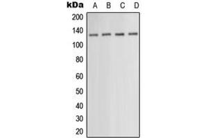 Western blot analysis of PKN1 expression in HEK293T (A), HepG2 (B), SP2/0 (C), NIH3T3 (D) whole cell lysates. (PKN1 antibody  (Center))