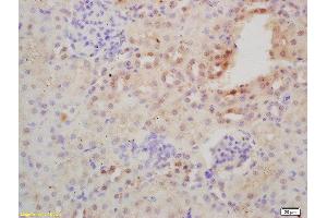 Formalin-fixed and paraffin embedded mouse kidney labeled with Rabbit Anti-NFKB Polyclonal Antibody, Unconjugated  at 1:200 followed by conjugation to the secondary antibody and DAB staining (NFKB2 antibody  (AA 151-250))