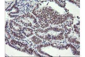 Image no. 2 for anti-SEC14 and Spectrin Domains 1 (SESTD1) antibody (ABIN1501066) (SESTD1 antibody)