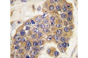 Immunohistochemistry (IHC) image for anti-BCL2 Binding Component 3 (BBC3) (AA 119-154) antibody (ABIN3030112)