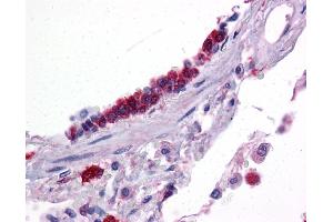 Immunohistochemistry (IHC) image for anti-Kruppel-Like Factor 2 (Lung) (KLF2) (Middle Region) antibody (ABIN2777573)