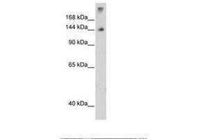 Image no. 3 for anti-Pre-mRNA Branch Site Protein p14 (SF3B14) (N-Term) antibody (ABIN203323) (Pre-mRNA Branch Site Protein p14 (SF3B14) (N-Term) antibody)