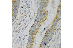 Immunohistochemistry of paraffin-embedded human colon carcinoma using GNAO1 Antibody (ABIN1872843) at dilution of 1:100 (40x lens). (GNAO1 antibody)