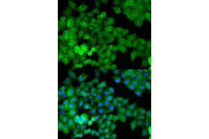 Immunofluorescence analysis of HeLa cells using JUP antibody (ABIN5970353). (JUP antibody)