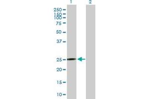 Western Blot analysis of MRPS10 expression in transfected 293T cell line by MRPS10 MaxPab polyclonal antibody. (MRPS10 antibody  (AA 1-201))