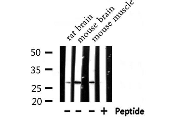 NDUFV2 antibody  (N-Term)