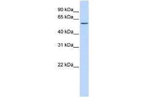 WB Suggested Anti-KIAA1754L Antibody Titration:  0. (ITPRIPL1 antibody  (C-Term))