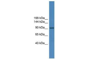 WB Suggested Anti-ZNF574 Antibody Titration:  0.