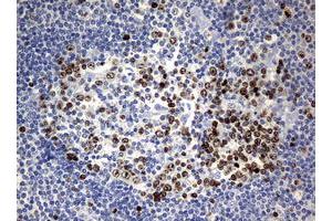 Image no. 6 for anti-Antigen Identified By Monoclonal Antibody Ki-67 (MKI67) (AA 1160-1493) antibody (ABIN1490857) (Ki-67 antibody  (AA 1160-1493))