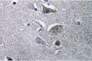 Immunohistochemistry (IHC) analyzes of NDUFV2 antibody in paraffin-embedded human brain tissue. (NDUFV2 antibody)