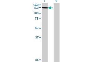 Western Blotting (WB) image for THBS4 293T Cell Transient Overexpression Lysate(Denatured) (ABIN1333723)