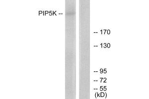 Western Blotting (WB) image for anti-phosphoinositide Kinase, FYVE Finger Containing (PIKFYVE) (N-Term) antibody (ABIN1850108)