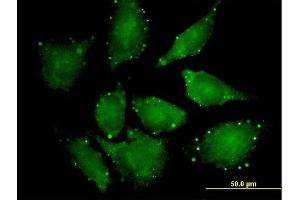 Immunofluorescence of purified MaxPab antibody to EIF4ENIF1 on HeLa cell. (EIF4ENIF1 antibody  (AA 1-985))