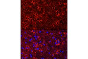 Immunofluorescence analysis of mouse brain cells using NTRK3 Rabbit pAb (ABIN6132429, ABIN6144910, ABIN6144912 and ABIN6221540) at dilution of 1:100 (40x lens). (NTRK3 antibody  (AA 40-300))