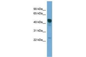 Image no. 1 for anti-Dyslexia Susceptibility 1 Candidate 1 (DYX1C1) (C-Term) antibody (ABIN6745673) (DYX1C1 antibody  (C-Term))
