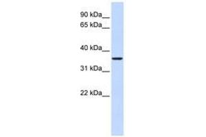 Image no. 1 for anti-Fructose-1,6-Bisphosphatase 2 (FBP2) (AA 216-265) antibody (ABIN6741005) (FBP2 antibody  (AA 216-265))