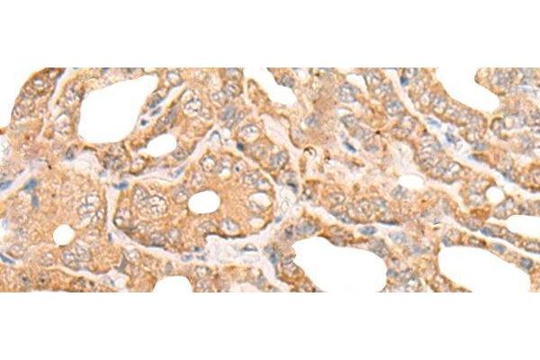 DEF8 antibody