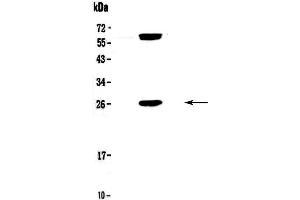 Western blot analysis of Bcl-2 using anti-Bcl-2 antibody . (Bcl-2 antibody  (AA 118-165))