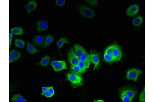 Immunofluorescent analysis of MCF-7 cells using ABIN7144733 at dilution of 1:100 and Alexa Fluor 488-congugated AffiniPure Goat Anti-Rabbit IgG(H+L) (GOT2 antibody  (AA 33-279))