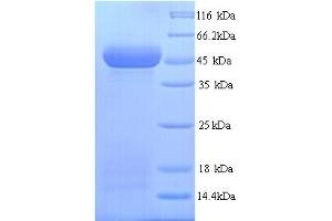 SDS-PAGE (SDS) image for Wingless-Type MMTV Integration Site Family, Member 10A (WNT10A) (AA 36-417) protein (His tag) (ABIN5714498) (WNT10A Protein (AA 36-417) (His tag))