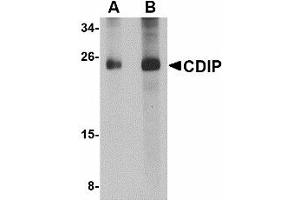 Image no. 1 for anti-LITAF-Like Protein (CDIP1) (Internal Region) antibody (ABIN478041) (CDIP1 antibody  (Internal Region))