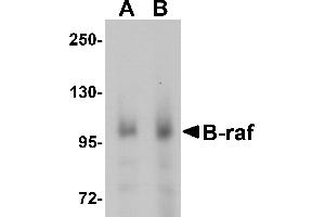 Western blot analysis of B-raf in human brain tissue lysate with B-raf antibody at (A) 1 and (B) 2 µg/mL.