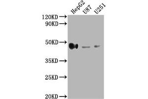 Western Blot Positive WB detected in: HepG2 whole cell lysate, U87 whole cell lysate, U251 whole cell lysate All lanes: HLA-G antibody at 1:2000 Secondary Goat polyclonal to rabbit IgG at 1/50000 dilution Predicted band size: 39, 28, 18, 37, 26, 14 kDa Observed band size: 45 kDa (HLAG antibody  (AA 25-200))