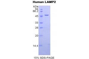 SDS-PAGE (SDS) image for Lysosomal-Associated Membrane Protein 2 (LAMP2) (AA 193-375) protein (His tag,GST tag) (ABIN1877974) (LAMP2 Protein (AA 193-375) (His tag,GST tag))