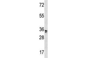 WDR5 antibody western blot analysis in A2058 lysate. (WDR5 antibody  (AA 12-40))