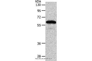 Western blot analysis of Mouse brain tissue, using INA Polyclonal Antibody at dilution of 1:550