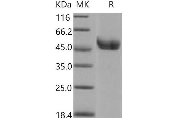 Renin Protein (REN) (His tag)