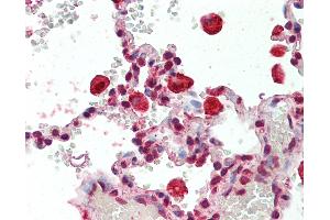 Human Lung, Macrophages: Formalin-Fixed, Paraffin-Embedded (FFPE) (CAPG antibody)