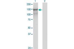 Western Blot analysis of PCDH10 expression in transfected 293T cell line by PCDH10 monoclonal antibody (M07), clone 2H6. (PCDH10 antibody  (AA 18-127))