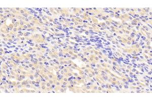 Immunohistochemistry (IHC) image for anti-Metalloproteinase Inhibitor 2 (TIMP2) (AA 27-220) antibody (ABIN7431137)