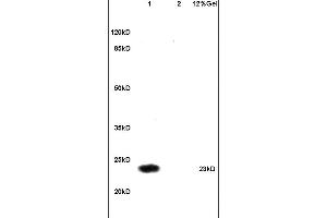 Lane 1: human colon carcinoma Lane 2: mouse brain lysates probed with Anti Securin/PTTG Polyclonal Antibody, Unconjugated (ABIN735803) at 1:200 in 4C. (PTTG1 antibody  (AA 101-202))