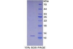 SDS-PAGE (SDS) image for S100 Calcium Binding Protein A8 (S100A8) (AA 1-89) protein (His tag) (ABIN1080752)