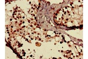 Immunohistochemistry of paraffin-embedded human testis tissue using ABIN7170295 at dilution of 1:100 (SLCO1C1 antibody  (AA 297-348))
