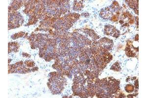 Image no. 1 for anti-Parathyroid Hormone (PTH) (C-Term) antibody (ABIN6166676) (PTH antibody  (C-Term))