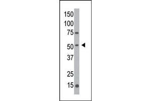 Western blot analysis of anti-hMGAT1- Pab (ABIN389036 and ABIN2839251) in Y79 cell line lysate. (MGAT1 antibody  (C-Term))