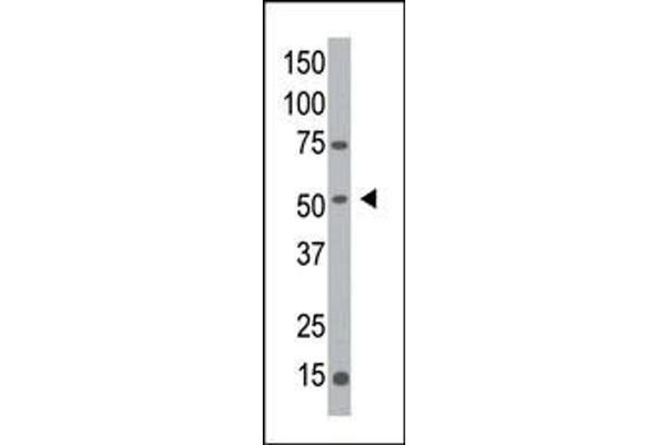 MGAT1 antibody  (C-Term)