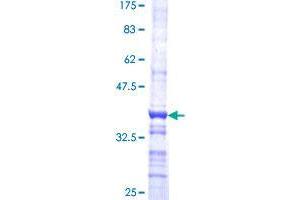 CDKL4 Protein (AA 196-295) (GST tag)