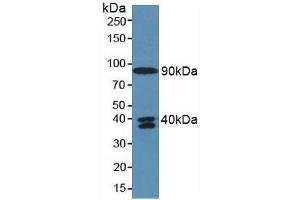 Detection of C4a in Human Serum using Polyclonal Antibody to Complement Component 4a (C4a) (C4A antibody  (AA 680-756))