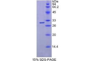 SDS-PAGE analysis of Human MYH4 Protein.