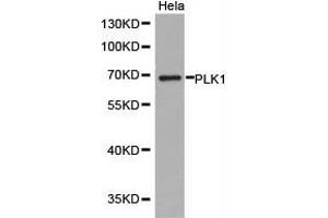 Western Blotting (WB) image for anti-Polo-Like Kinase 1 (PLK1) antibody (ABIN1874166) (PLK1 antibody)