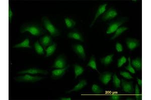 Immunofluorescence of monoclonal antibody to MAPK3 on HeLa cell. (ERK1 antibody  (AA 279-379))